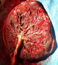 fba2cd05fc45ce91813c523805979006--human-placenta-medical-pictures